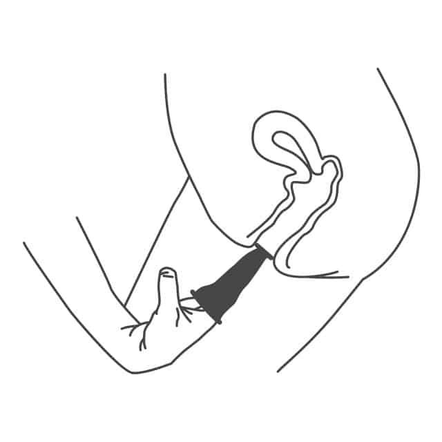 To insert a female condom, squeeze and insert the smaller ring at the closed end into the vagina
