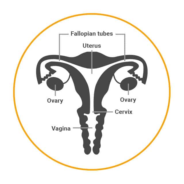 Female sterilisation involves cutting, sealing or blocking the fallopian tubes