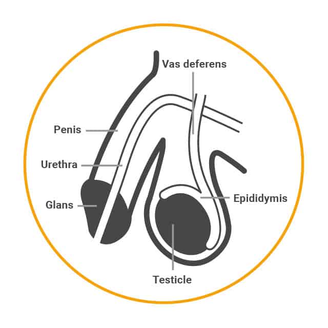 Male sterilisation is done by cutting and sealing or tying the vas deferens